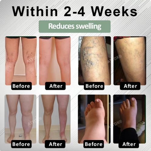 ATTDX® FlowBoost Edema Drain Herbal Roll On