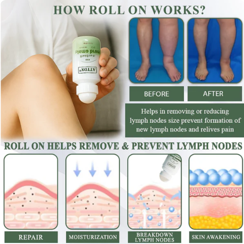ATTDX® FlowBoost Edema Drain Herbal Roll On