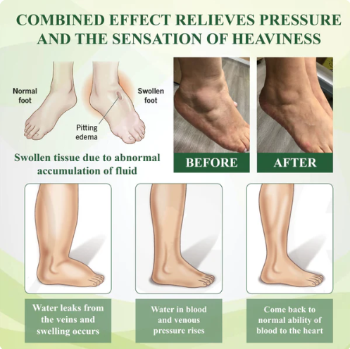 ATTDX® FlowBoost Edema Drain Herbal Roll On