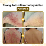 Relieflogix PsoriaSoothe Skin Care Cream