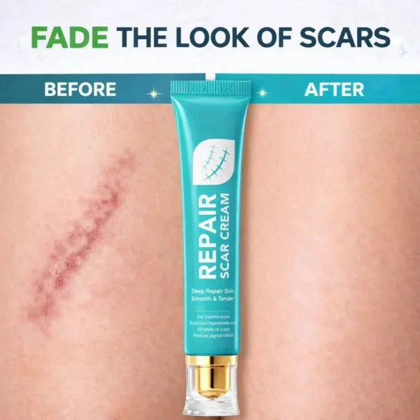 Gentle Scar Repair Cream