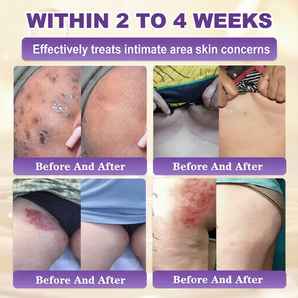 Biotin Skin Restoration Beauty Cream