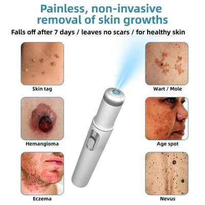 Bikenda® 🔥🔥 Non-Invasive Mole and Wart Removal Laser Pen